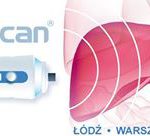 fibroscan intermedis