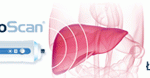intermedis fibroscan